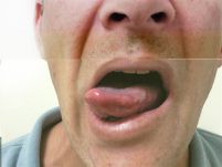 kritat-lashon-im-shijzur